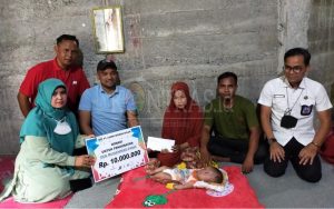 Bantu Pengobatan Bayi Penderita Hidrosefalus, PT. UND Nara Salurkan Donasi