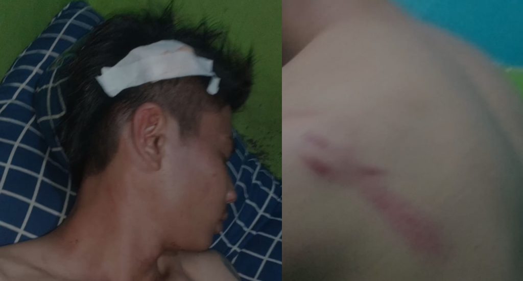 Sopir Taksi di Gorontalo Diduga Dikeroyok 2 Polisi, Korban Dilarikan ke Puskesmas