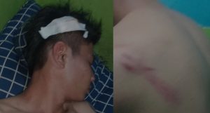 Sopir Taksi di Gorontalo Diduga Dikeroyok 2 Polisi, Korban Dilarikan ke Puskesmas