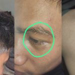 Korban Pengeroyokan Polisi
