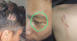 2 Polisi Terduga Pelaku Pengeroyok Sopir Taksi Diadukan ke Polda Gorontalo