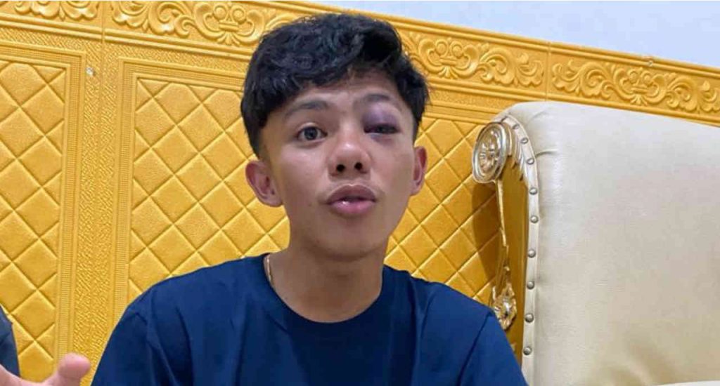 Polisi di Gorontalo Diduga Aniaya Anak 17 Tahun dengan Senjata, Mata Korban Nyaris…