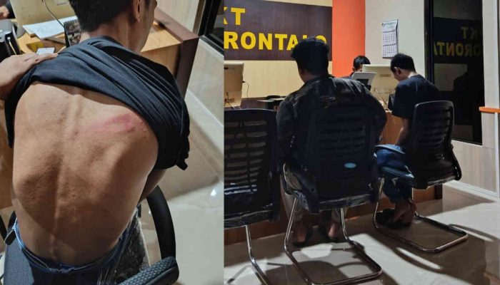 Koordinator BEM Nusantara Gorontalo Diserang 4 Orang Tak Dikenal, Upaya Pembungkaman Kritik?