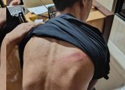 Koordinator BEM Nusantara Gorontalo Dianiaya OTK Berkostum Ninja