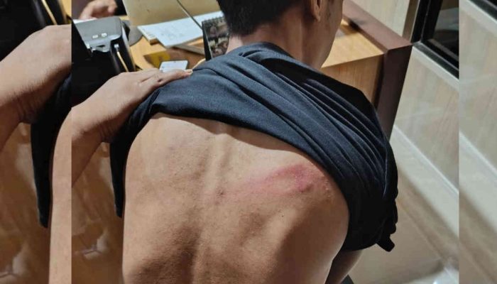 Koordinator BEM Nusantara Gorontalo Dianiaya OTK Berkostum Ninja